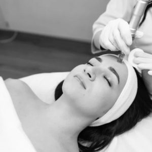 Microneedling Pkg of 3 â€“ Face/Neck