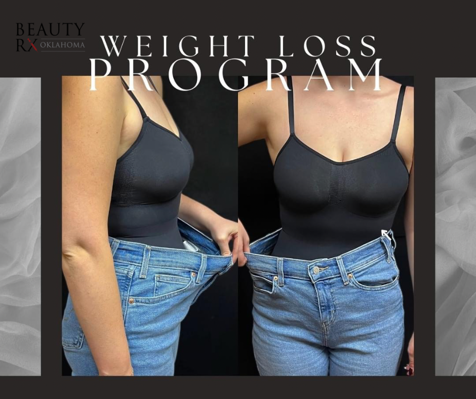 12 week weight loss program